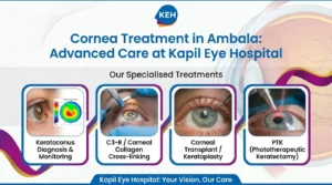 Cornea Treatment in Ambala: Keratoconus, C3-R, Corneal Transplant, PTK & Advanced Cornea Care at Kapil Eye Hospital